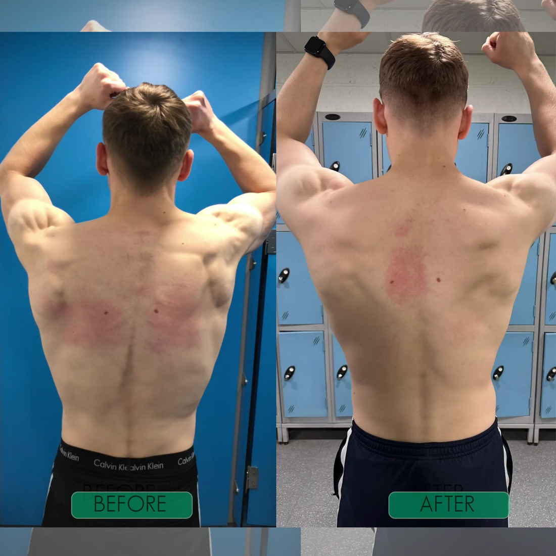 AlignPro — Invisible Posture Corrector for Instant Relief