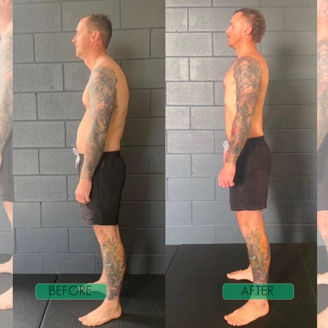 AlignPro — Invisible Posture Corrector for Instant Relief