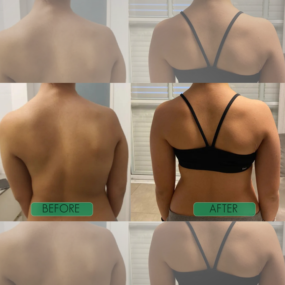 AlignPro — Invisible Posture Corrector for Instant Relief
