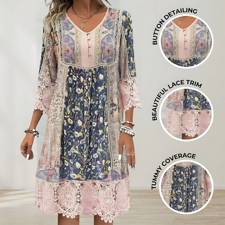 Women's Patchwork Lace Detail Dress - Effortless Everyday Charm
