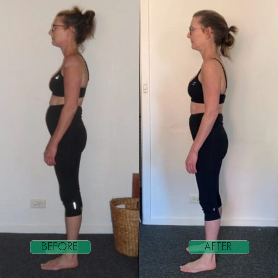 AlignPro — Invisible Posture Corrector for Instant Relief